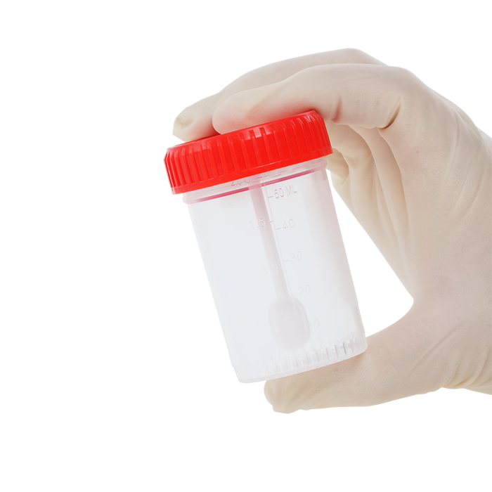 Dynarex Stool Specimen Container with Spoon, 60mL (400 Count)